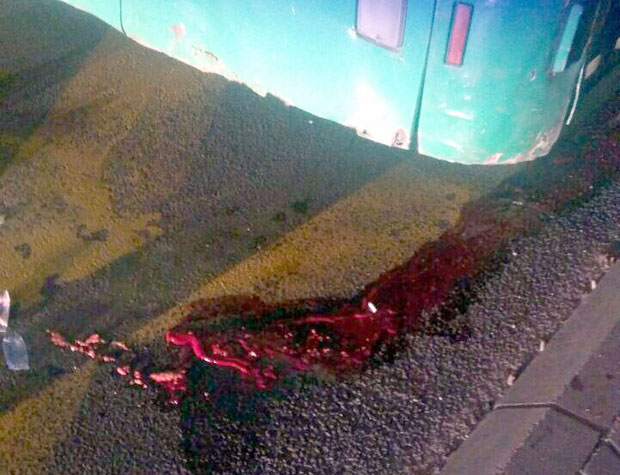 СТРАВИЧНА НЕСРЕЋА У КРАГУЈЕВЦУ: Жена остала без ноге, а возача оџепарили!